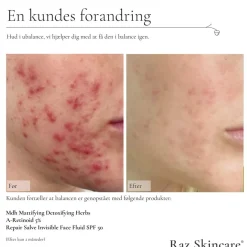 A-Retinoid 5% Serum, 30 ml