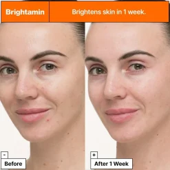Brightamin Brightening Serum Ampoule, 8 ml