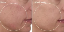 Cellular Hydration Repair Cream, 50 ml