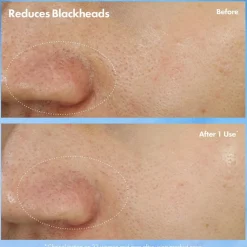 Clear Improvement Blackhead Clearing Mask-To-Scrub, 75 ml