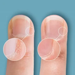 Cuticle Eraser