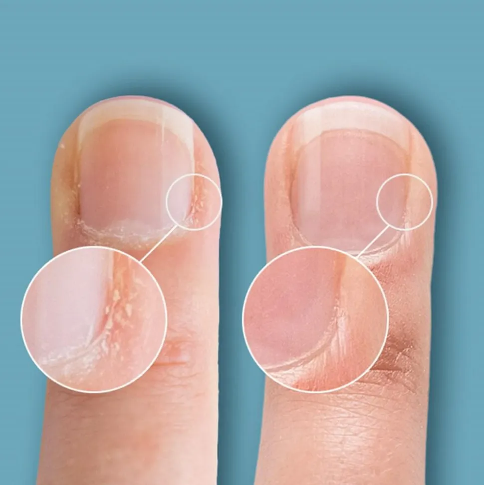 Cuticle Eraser