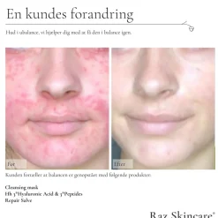 Hh 3*Hyaluronic Acid & 3*Peptides, 30 ml