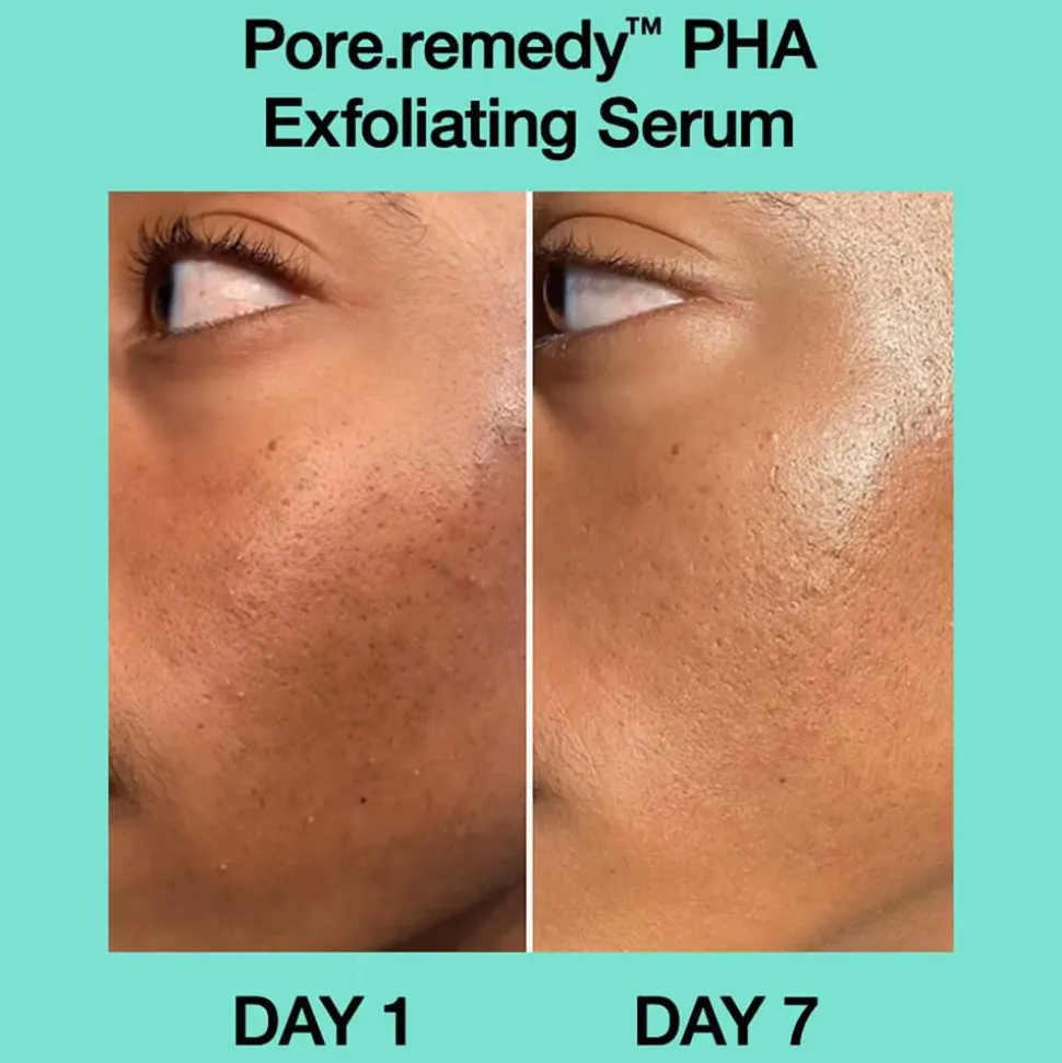Pore·remedy™ PHA Exfoliating Serum, 30 ml