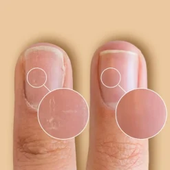 Solaroil Nail Care