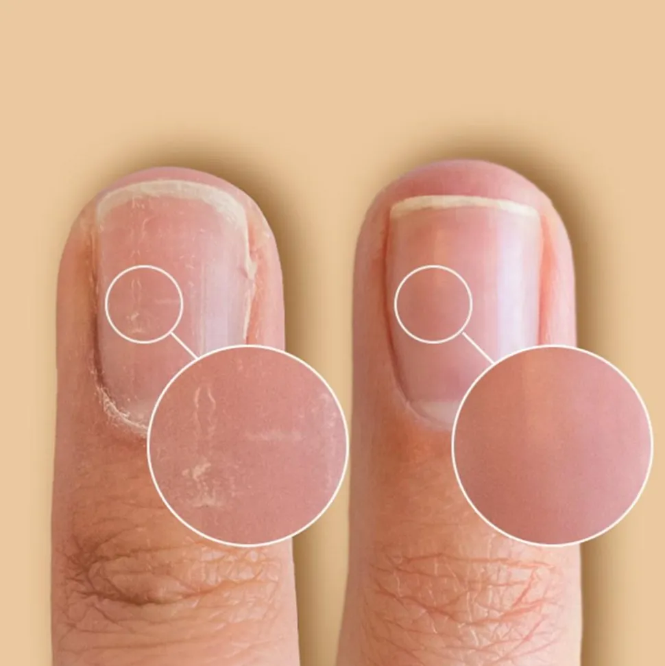 Solaroil Nail Care
