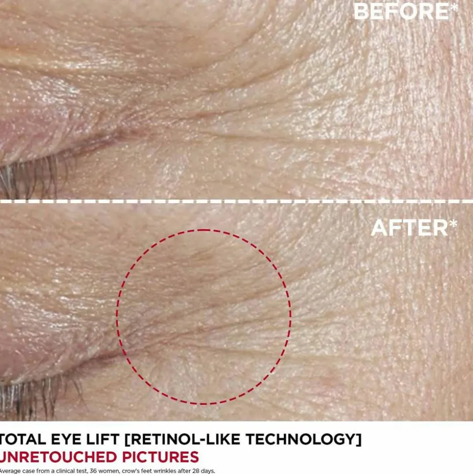Total Eye Lift Refill, 15 ml