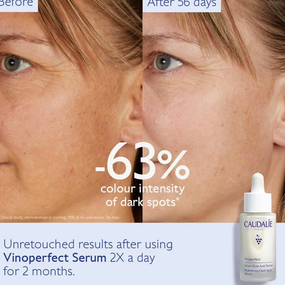 Vinoperfect Brightening Dark Spot Serum, 30 ml